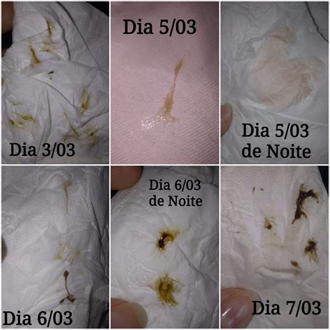 Como Saber Se É Sangramento De Nidação - Será Menstruação ou Sangramento de Nidação? Sera que alguem aqui ja ...