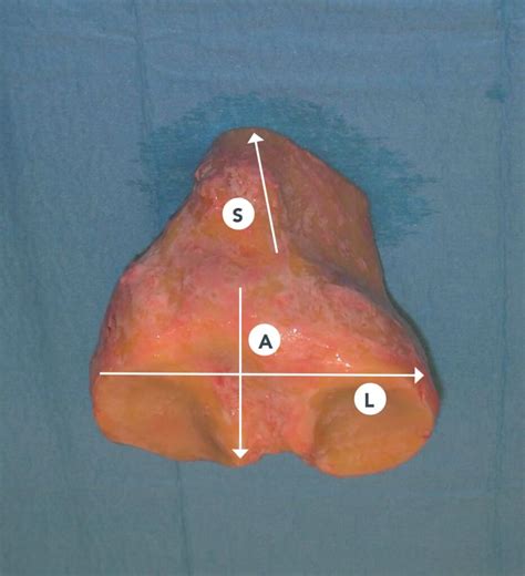 tibial plate fbtv lab