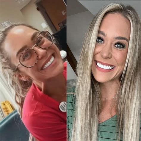 I wish Holley saw that her real face is much better than the skinny