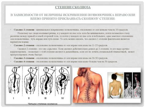 Физическая реабилитация больных со сколиозом - презентация онлайн
