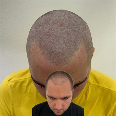 Gallery – Our Work | Hairline Studios