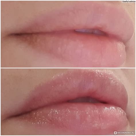 Бальзам для губ MBR Basic Lip-ID - «Супер увлажнение для губ» | отзывы