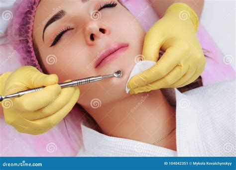 Professional Cleansing of Acne in a Beauty Salon. Stock Image - Image ...