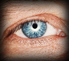 eye condition