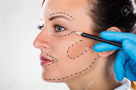 Plastic Surgery Drawing at GetDrawings | Free download