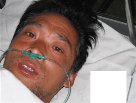 Hisashi Ouchi After Radiation: A Deep Dive Into His Tragic Story And ...
