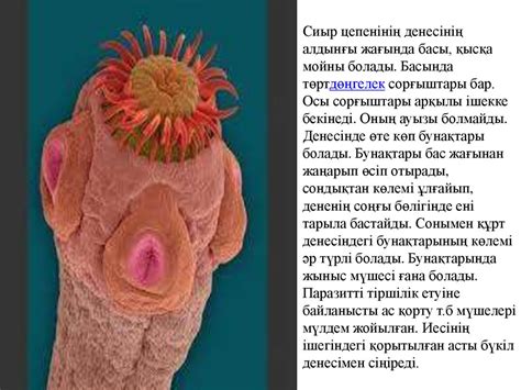 Гельминтоздар - презентация онлайн