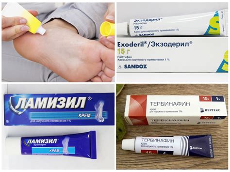 ЛОТРИМИН: инструкция по применению, цена мази
