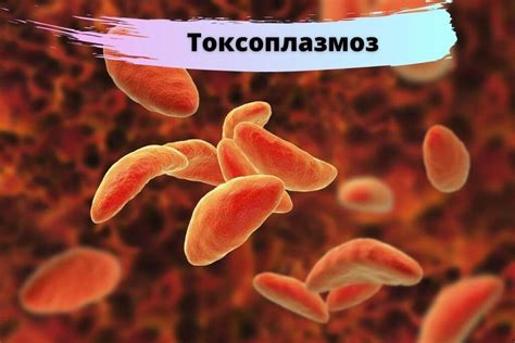 Токсоплазмоз: что такое, симптомы, опасность при беременности, лечение ...