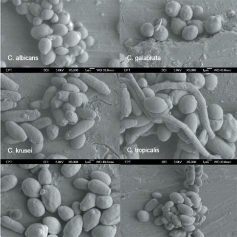 (PDF) Non-Candida albicans Candida yeasts of the oral cavity