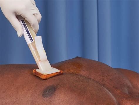 patient preoperative prep surgical wound irrigation  skin antiseptics