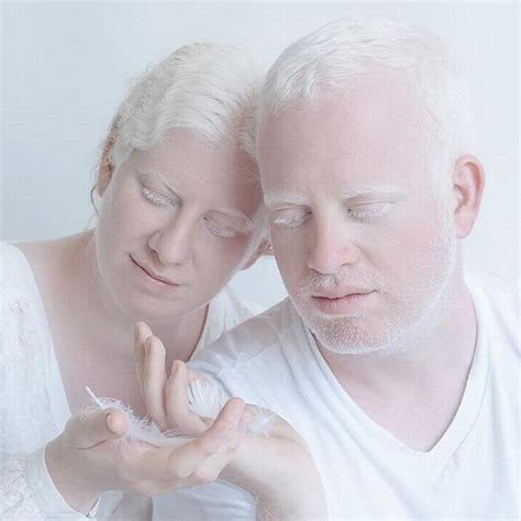 20 Stunning Portraits Showing Albinism's Beauty