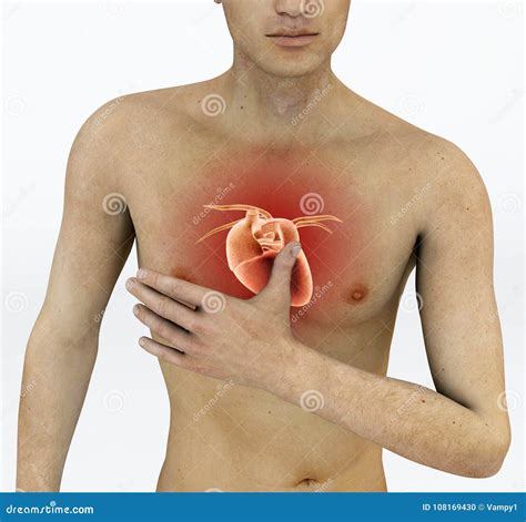 Heart Attack, Chest Pain. Arrhythmia, Heart Problems Stock Photo ...