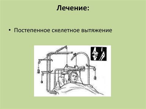 Перелом хирургической шейки плечевой кости - online presentation