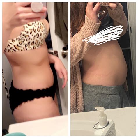 Does this seem like a normal amount of bloat to happen often? I feel