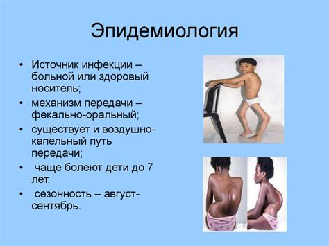 Полиомиелит. Эпидемиология - презентация онлайн