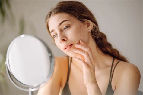 Medspa Treatments For Acne | Bloomtime Aesthetics