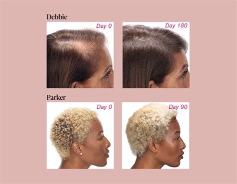 The Essentials Collection | Viviscal Hair Health