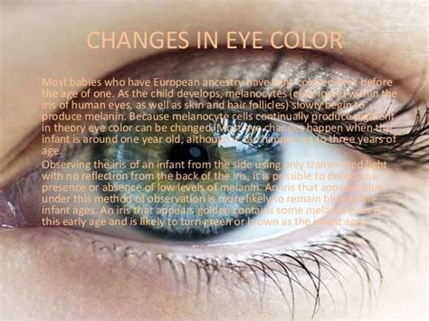 Eye color