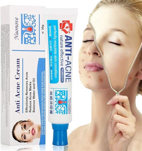 Creme Acne Visage, Acne Creme, Anti Acné creme, Creme Cicatrice Acne ...