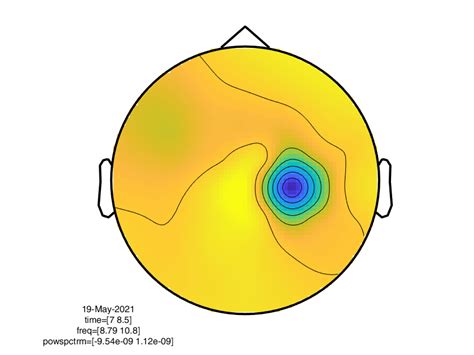 left hand related eeg topography   frequency band