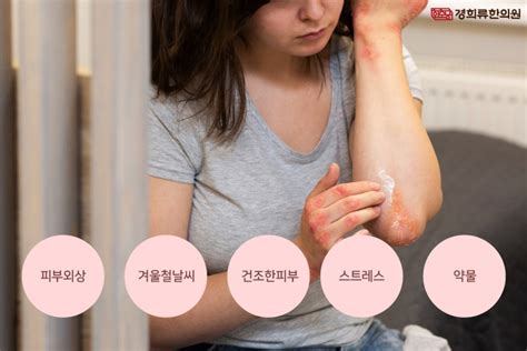 팔꿈치건선 건조해진 겨울 팔꿈치각질, 피부질환 고민