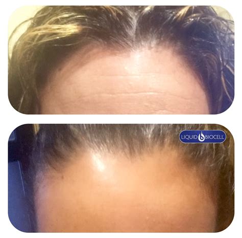 SKIN Liquid Biocell, Modere Liquid BioCell Collagen - Collagen Collective