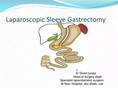 PPT - Laparoscopic Sleeve Gastrectomy PowerPoint Presentation, free ...