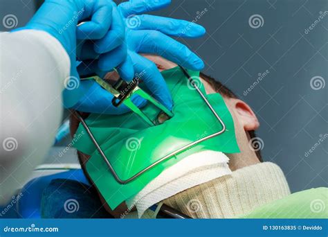 The dentist repair stock image. Image of fillings, doctor - 130163835