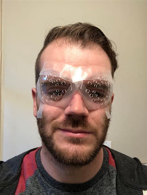 Can You Wear Glasses After Laser Eye Surgery at Zane Steigrad blog