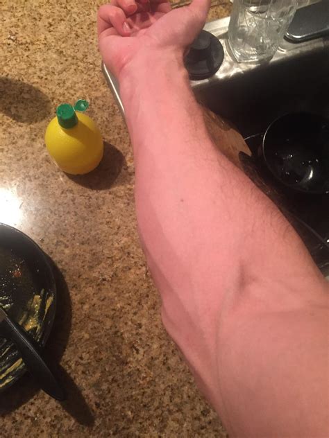 Anavar, Testosterone Cypionate, Winstrol: Everything I Experienced On