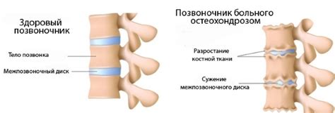 Валик для спины. Как на нем лежать: можжевеловый, массажный, спортивный ...