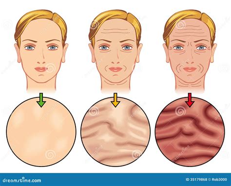 skin aging vector illustration cartoondealercom