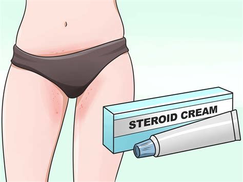 5 formas de acabar con la comezón vaginal - wikiHow