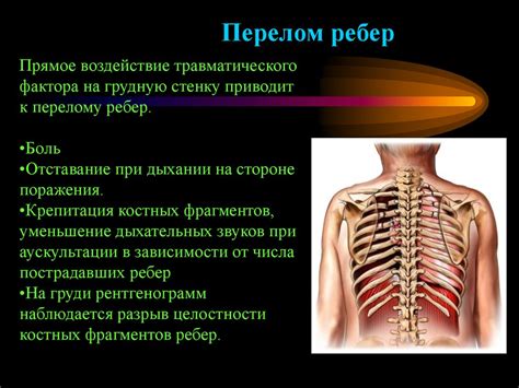Перелом ребер - презентация онлайн