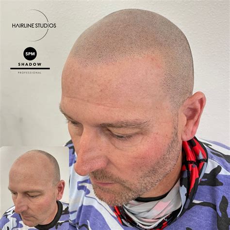 Gallery – Our Work | Hairline Studios