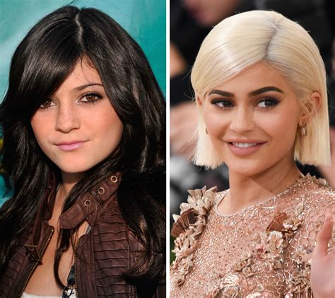 Kim Kardashian Plastic Surgery Before After Kim Kardashian Has Always