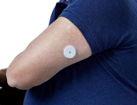 Prick-free continuous glucose monitor – ApplySci – Deep Tech Health ...