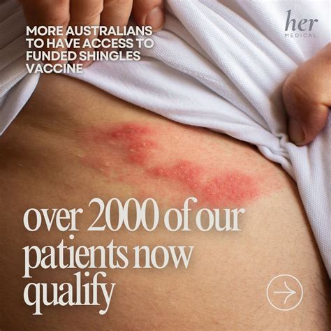 important update  eligible patients shingles vaccination access
