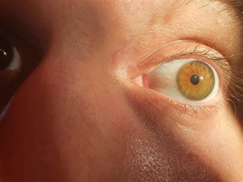 amber : eyes