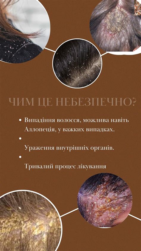 Трихологія, грибок волосся i 2025