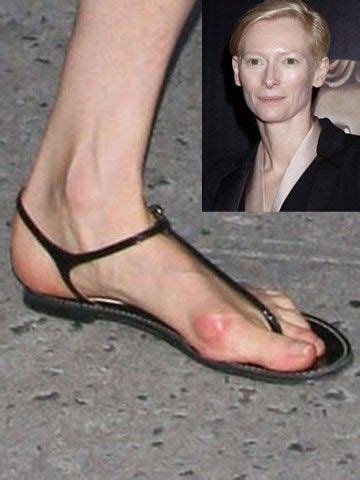 Tilda Swinton Bunion Shoes, Ballet Feet, Tilda Swinton, Infographic ...