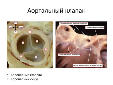 Хирургическая анатомия сердца - презентация онлайн