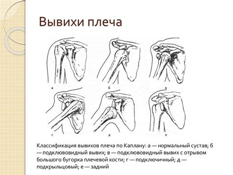 Топографическая анатомия и оперативная хирургия верхней конечности ...