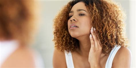 chin hair  women   means     rid