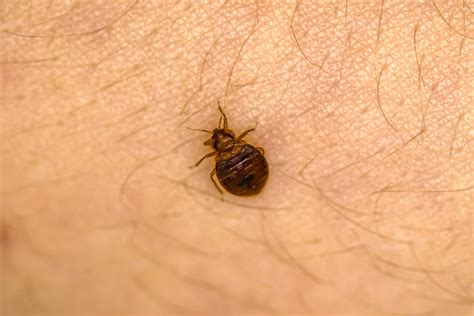 家中的臭虫、床虱怎么除【附图】臭虫怕什么？ • 美国生活指南