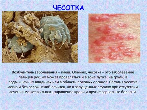 Кожные заболевания - презентация онлайн