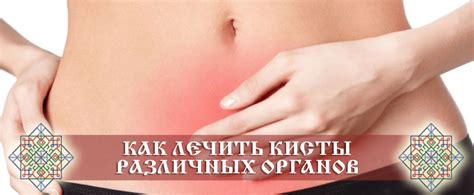 Как лечить кисты народными средствами. Причины
