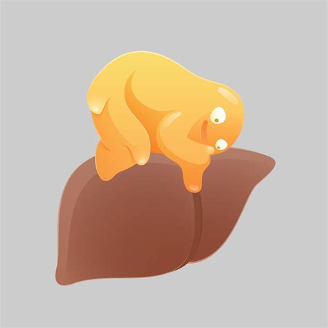 Cartoon concept for fatty liver disease or hepatic steatosis disease
