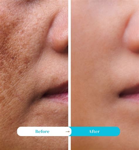Best Genuine Skin Whitenning Cream For Men And Women In Pakistan ...